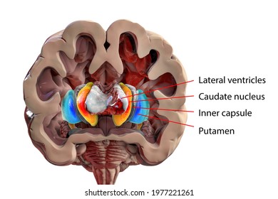 Human Brain Anatomy, Basal Ganglia. 3D Illustration Showing Caudate Nucleus (orange), Putamen (blue), And Lateral Ventricles (gray)