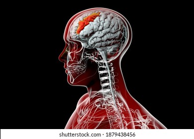 Human Brain In The Body With Highlighted Middle Frontal Gyrus, 3D Illustration. It Is The Part Of Prefrontal Cortex Of The Frontal Lobe. It Is Involved In The Language Learning And Attention