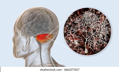 Human Brain With Highlighted Cerebellum And Close-up View Of Purkinje Neurons, One Of The Commonest Types Of Cells In Cerebellar Cortex, 3D Illustration