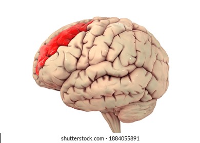 Human Brain With Highlighted Middle Frontal Gyrus, 3D Illustration. It Is The Part Of Prefrontal Cortex Of The Frontal Lobe. It Is Involved In The Language Learning And Attention