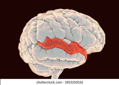 Human Brain With Highlighted Superior Temporal Gyrus, 3D Illustration. It Is Located In The Temporal Lobe, Contains The Auditory Cortex, Is Responsible For The Sensation Of Sound And The Processing Of