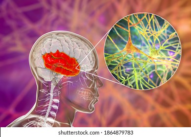 Human brain with highlighted temporal lobe and close-up view of pyramidal neurons found in temporal cortex, 3D illustration