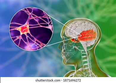 Human brain with highlighted temporal lobe and close-up view of pyramidal neurons found in temporal cortex, 3D illustration