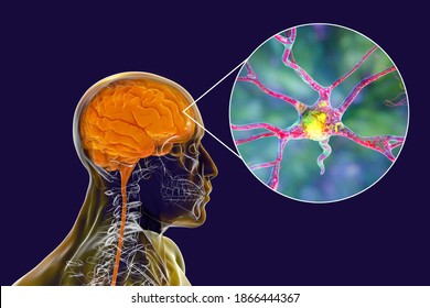 Human brain inside the body with closeup view of neurons, brain cells, 3D illustration