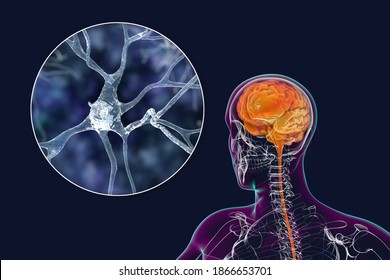 Human brain inside the body with closeup view of neurons, brain cells, 3D illustration