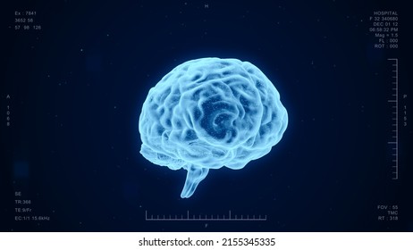 Human brain medical diagnosis interface, futuristic ct scan hologram science and research technology, AI computer screen 3d rendering