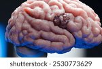 Human brain nervous system anatomy, neural cancer, Sebaceous bulb, brain cancer tumor malignant cells growth and spreading, Meningioma, neurological disease, metastasis cancerous, cerebrum, 3d render