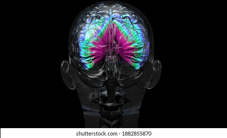 Human Brain, Neurones Connections. Colorful Brain MRI Scan