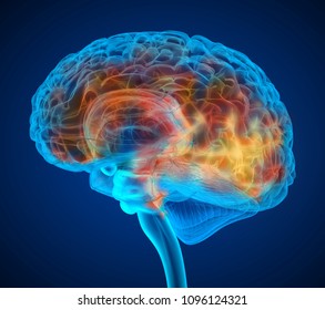 Human brain tumor X-ray scan , Medically accurate 3D illustration