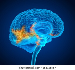 Human Brain Tumor X-ray Scan , Medically Accurate 3D Illustration 