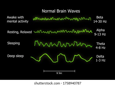 Human Brain Waves Diagram , Chart  Illustration