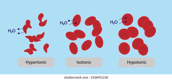 Human Cell Osmosis. Hemoglobin In A Isotonic, Hypertonic And Hypotonic Illustration 