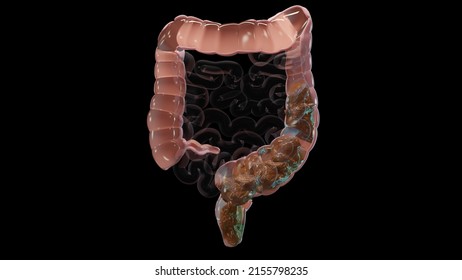 human digestive system anatomy, concept of the intestine, laxative, traitement of constipation, 3d render