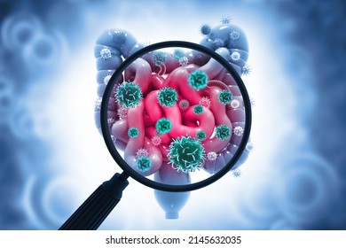 Human Digestive System Infected By Virus Or Bacteria. 3d Illustration 