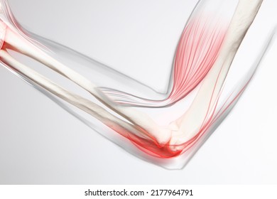 Human elbow pain, arm and bone 3d illustration - Powered by Shutterstock