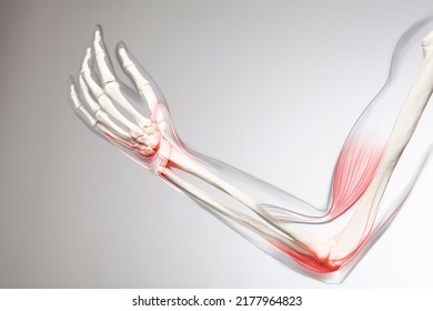 Human elbow pain, arm and bone 3d illustration - Powered by Shutterstock