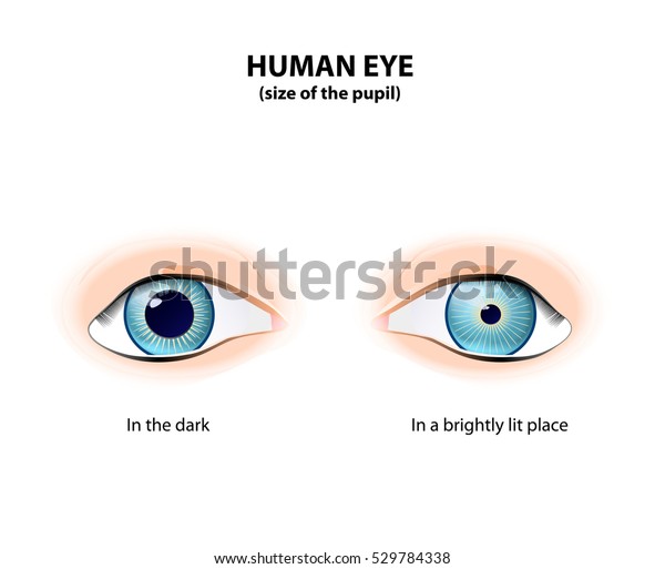 constricted pupil size meaning