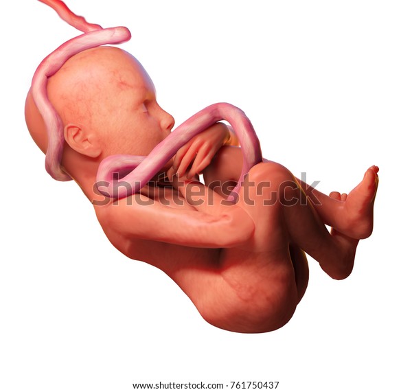 Foetus Humain Avec Cordon Ombilical Autour Illustration De Stock