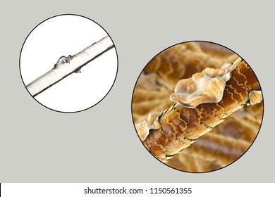 Human Hair Microscope Images, Stock Photos & Vectors | Shutterstock