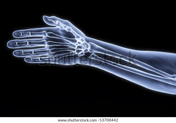 human hand under xrays stock illustration 53700442