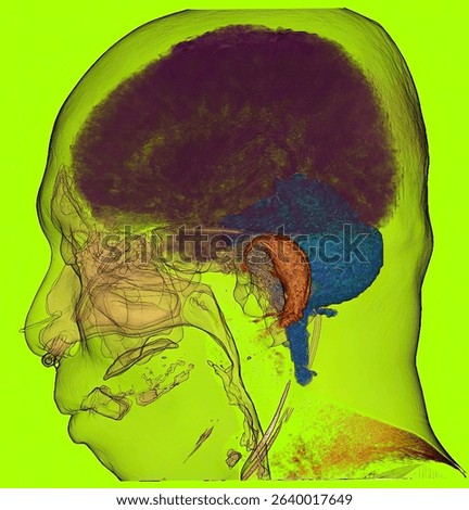 Human Head in Abstract Layers, Psychedelic Skull, Surreal Digital Anatomy, Futuristic Brain Scan with Vibrant Overlay