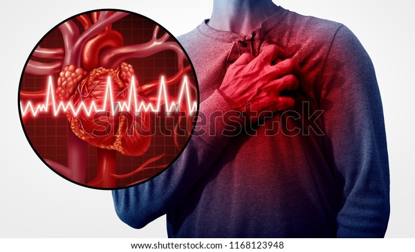 心臓疾患の患者を痛みを伴う3dイラスト形式の冠動脈イベントとして持つ 解剖学的な医学的疾患のコンセプトとしてのヒトの心臓発作痛 のイラスト素材