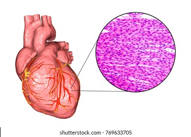 Cardiac Muscle Images Stock Photos Vectors Shutterstock