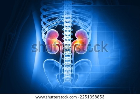 Human kidney medical diagram, anatomy of the kidney, diseased kidney. 3d illustration Stock photo © 