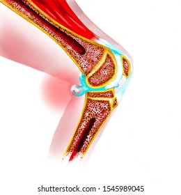 Human Knee Joint, Baker's Cyst Anatomy