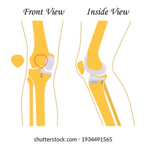Vom menschlichen Knie aus, Vorderseite und Rückseite. Illustration. Flachdesign