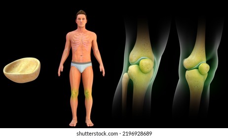 Human Know Patella Bone Anatomy 3d Illustration