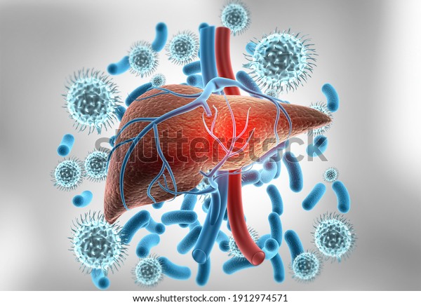 Human liver anatomy with hepatitis
virus. 3d
illustration		