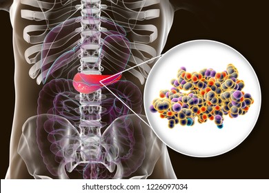 Human Pancreas And Close-up View Of Insulin Molecule, 3D Illustration