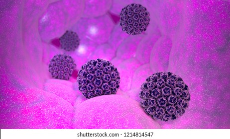 Human papillomavirus infection. Virus. HPV is the most common sexually transmitted infection globally. HPV infection is caused by human papillomavirus, a DNA virus, 3d rendering