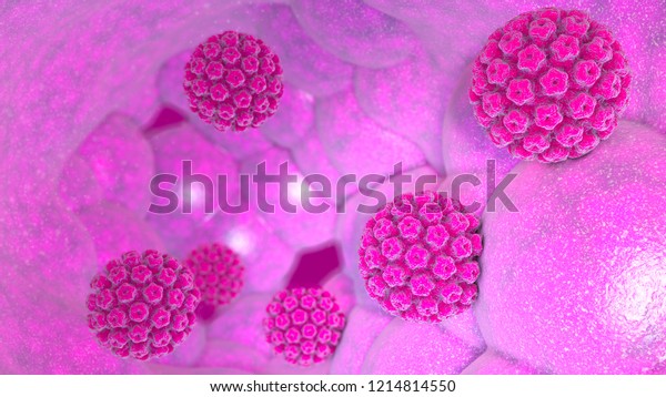 Human\
papillomavirus infection. Virus. HPV is the most common sexually\
transmitted infection globally. HPV infection is caused by human\
papillomavirus, a DNA virus, 3d\
rendering