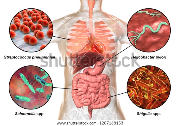 ヒト病原性微生物 呼吸器系及び腸内病原体 3dイラスト 肺炎連鎖球菌 ヘリコバクター ピロリ菌 サルモネラ菌 シゲラ菌 のイラスト素材