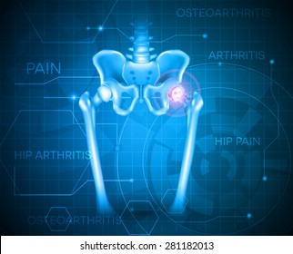 Human pelvis hip pain, abstract blue background. Hip arthritis