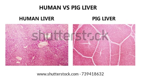 Human and pig liver histology. Comparison of light photomicrographs showing presence of well demarkated interlobular septae from connective tissue in pig liver in contrast to human liver Stock photo © 