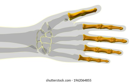 Phalanges Images, Stock Photos & Vectors | Shutterstock