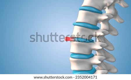 Human spine bulging or herniated disc 3D illustration Stock photo © 