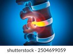 Human Spine Disc Degeneration - Spine Problems - 3D illustration