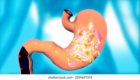 Human Stomach And Intestinal Bacteria. 3d Illustration	