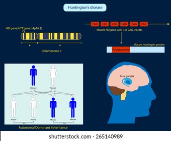 Huntington's Disease