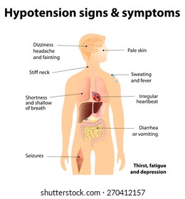 Hypotension signs & symptoms. Low blood pressure symptoms