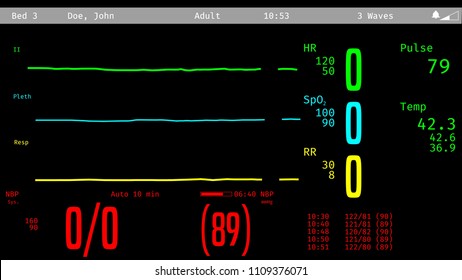 ICU screen monitoring dying patient, vital signs dropping, clinical death. 3D illustration
