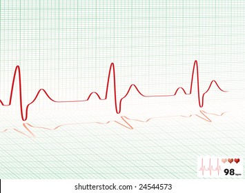 Illustrated Heartbeat Monitor With A Readout And Copy Space