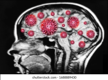 Illustration 3D  MRI Virus Scan Brain Skull X-ray And Central Nervous System System  Antomy Concept Coronavirus Vaccine Flu Shot Treatment. On Black Background Sective Focus.