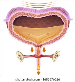 Illustration Of The Bladder Where The Sphincter Is Located And Urinary Incontinence Problems Originate.