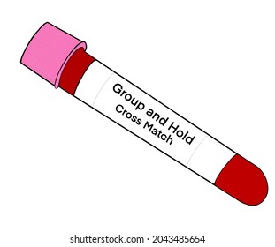 Illustration Of A Blood Bottle Used For Blood Grouping And Cross Matching