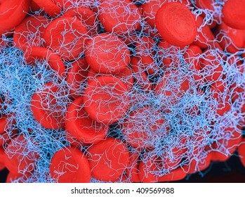 Illustration Of A Blood Clot Showing A Clump Of Red Blood Cells Intertwined In A Fibrin Mesh